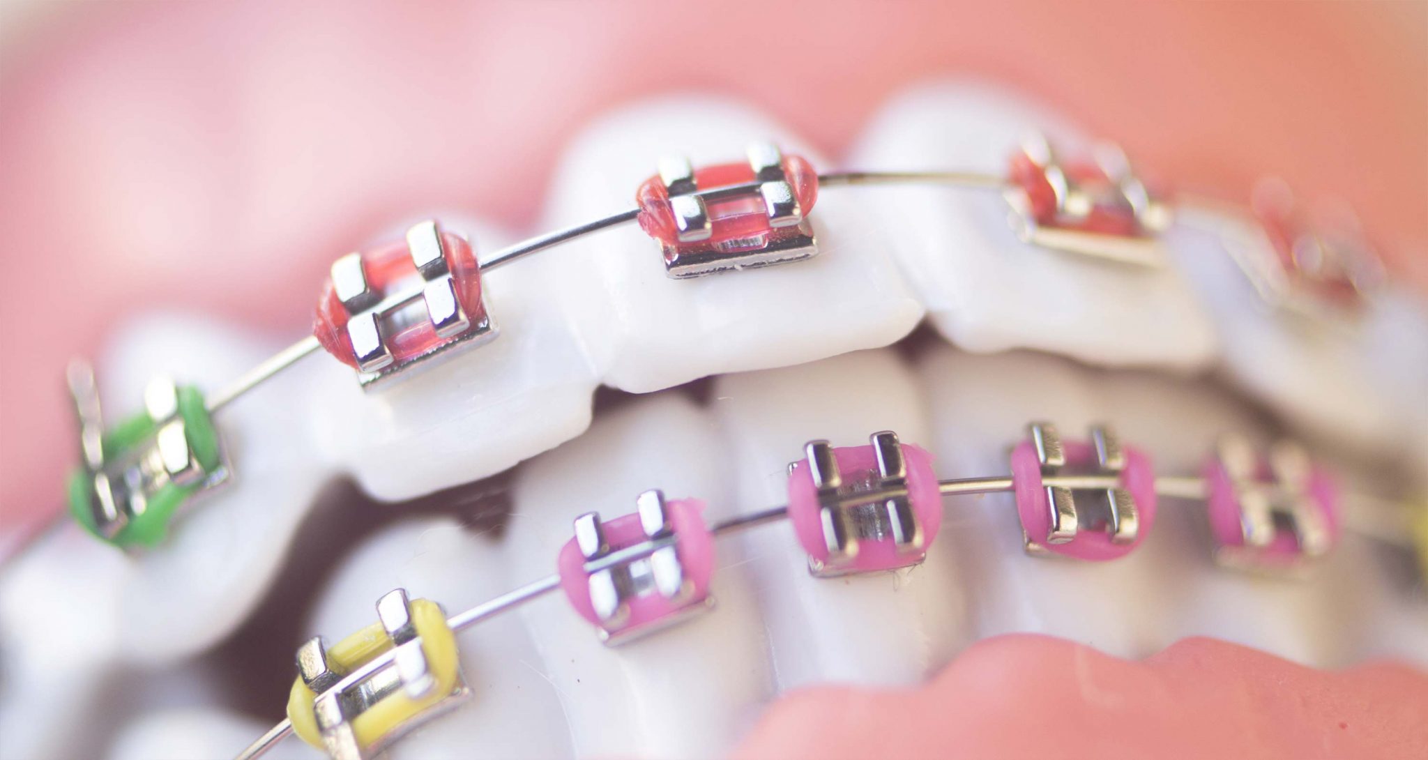 Orthodontic Services - Bloxham Dental Practice